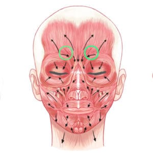 M. corrugator supercilii und seine Rolle bei der Bildung der Zornesfalte