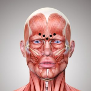 Botox against frown line