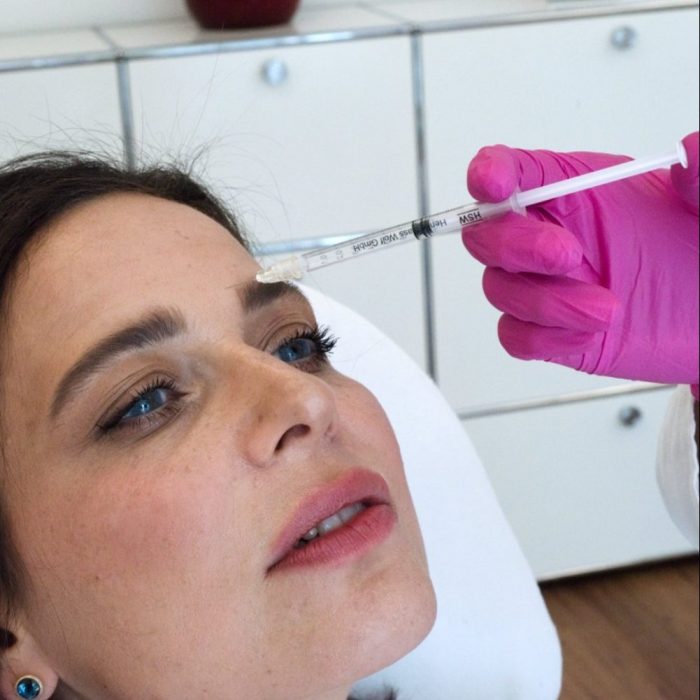 Micro Botox Micro BOTOX Behandlung in München bei LIPS and SKIN
