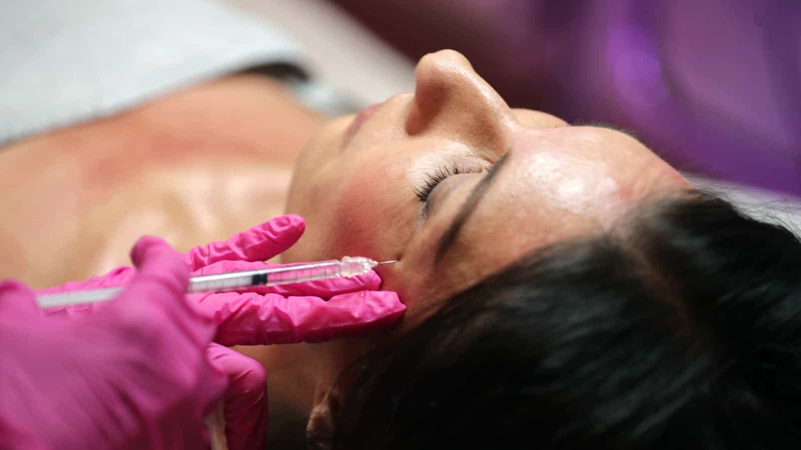 Crow's feet Botox, LIPS and SKIN Ästhetische Medizin