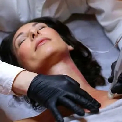 Microneedling München