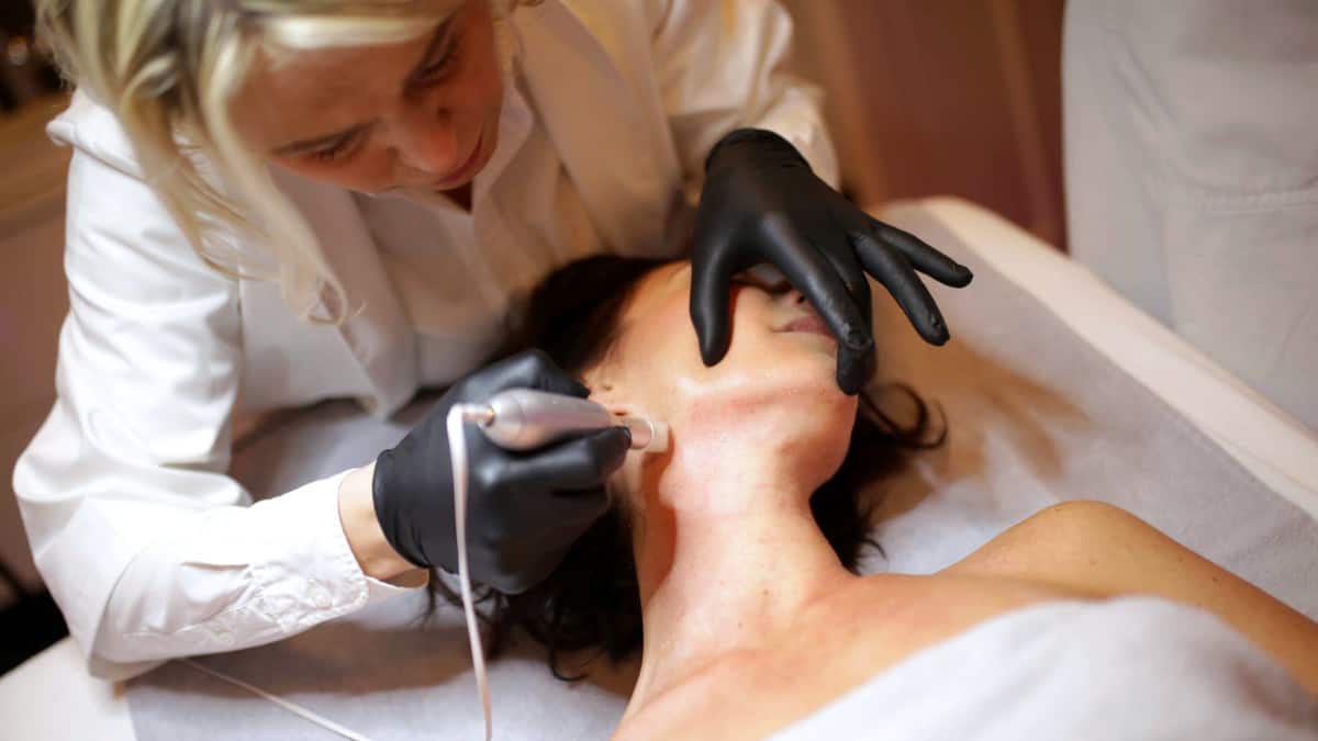 Microneedling bei LIPS and SKIN, München