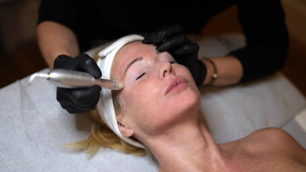 PRP injections against dark under-eye circles and bags