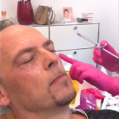 Augenringe unterspritzen München -2 Augenringe unterspritzen München