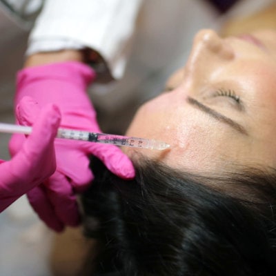 Botox for Forehead Wrinkles Smoothing Forehead Lines Without Regret