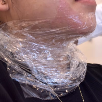 Doppelkinn entfernen München