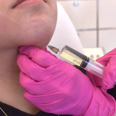 Doppelkinn entfernen München