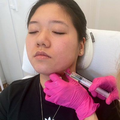 The picture shows a young patient whose double chin is currently being treated with the fat removal syringe