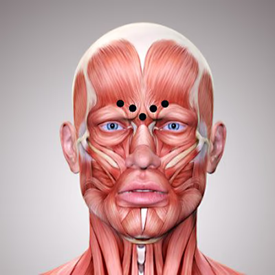 Botox Behandlung der Zornesfalte