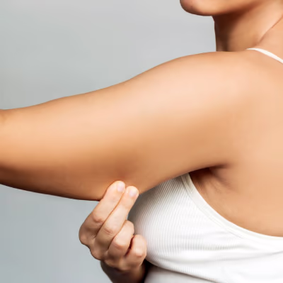 Fett weg Spritze München - auch für die Oberarme geeignet