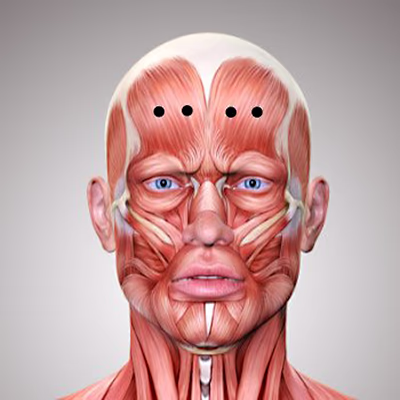 Botox Behandlung der Stirnfalten