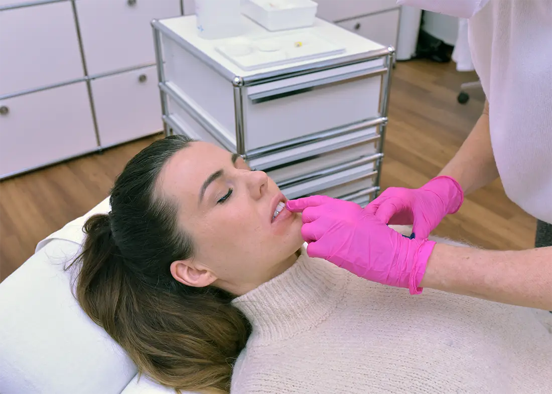 Lippen Aufspritzen bei Dr. Eva Maria Strobl in München Patient during lip treatment at LIPS and SKIN in Munich.